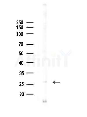 MITD1 Antibody - Western blot analysis of lysates from Hela cells(starvation,24h treatment), using MITD1 Antibody at 1/1000 dilution.