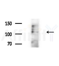 MLN51/CASC3 Antibody - Western blot analysis of extracts from Mouse liver, using MLN51/CASC3 Antibody at 1/1000 dilution.