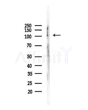 MLN51/CASC3 Antibody - Western blot analysis of lysates from Mouse liver, using MLN51/CASC3 Antibody at 1/1000 dilution.