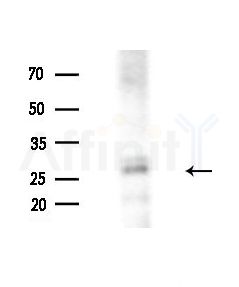 MMAB Antibody - Western blot analysis of extracts from HepG2 cells(LPS, 4h treatment), using MMAB Antibody at 1/1000 dilution.