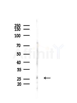 MMAB Antibody - Western blot analysis of lysates from HepG2 cells(LPS, 4h treatment), using MMAB Antibody at 1/1000 dilution.
