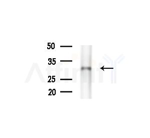 MTCH2 Antibody - Western blot analysis of extracts from Rat liver, using MTCH2 Antibody at 1/1000 dilution.