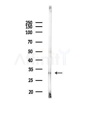 MTCH2 Antibody - Western blot analysis of lysates from Rat liver, using MTCH2 Antibody at 1/1000 dilution.