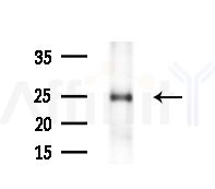 MXD1 Antibody - Western blot analysis of extracts from Rat liver, using MXD1 Antibody at 1/1000 dilution.