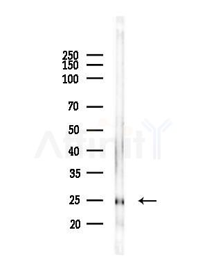 MXD1 Antibody - Western blot analysis of lysates from Rat liver, using MXD1 Antibody at 1/1000 dilution.