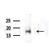 NHP2 Antibody - Western blot analysis of extracts from Rat liver, using NHP2 Antibody at 1/1000 dilution.
