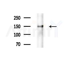 NPHP3 Antibody - Western blot analysis of extracts from Mouse brain, using NPHP3 Antibody at 1/1000 dilution.