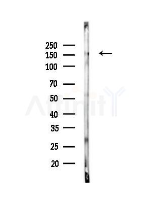 NPHP3 Antibody - Western blot analysis of lysates from Mouse brain, using NPHP3 Antibody at 1/1000 dilution.