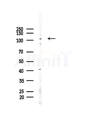 OSMR Antibody - Western blot analysis of lysates from HepG2 cells(LPS, 4h treatment), using OSMR Antibody at 1/1000 dilution.