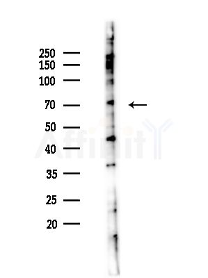 PCK2 Antibody - Western blot analysis of lysates from Hela cells(starvation,24h treatment), using PCK2 Antibody at 1/1000 dilution.