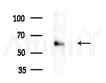 PCSK9 Antibody - Western blot analysis of extracts from HepG2 cells(heat-shock treatment), using PCSK9 Antibody at 1/1000 dilution.