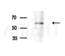 PCSK9 Antibody - Western blot analysis of extracts from Hela cells(heat-shock treatment), using PCSK9 Antibody at 1/1000 dilution.