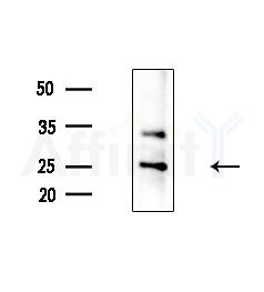 PHD3 Antibody - Western blot analysis of extracts from HepG2 cells(LPS, 4h treatment), using PHD3 Antibody at 1/1000 dilution.