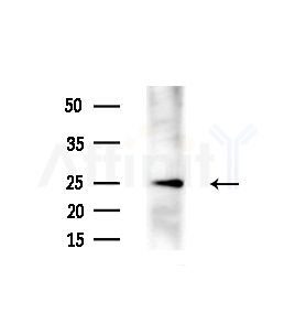 PHD3 Antibody - Western blot analysis of extracts from Hela cells(starvation, 24h treatment), using PHD3 Antibody at 1/1000 dilution.