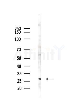 PHD3 Antibody - Western blot analysis of lysates from Hela cells(starvation, 24h treatment), using PHD3 Antibody at 1/1000 dilution.