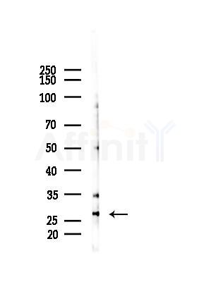 PHD3 Antibody - Western blot analysis of lysates from HepG2 cells(LPS, 4h treatment), using PHD3 Antibody at 1/1000 dilution.
