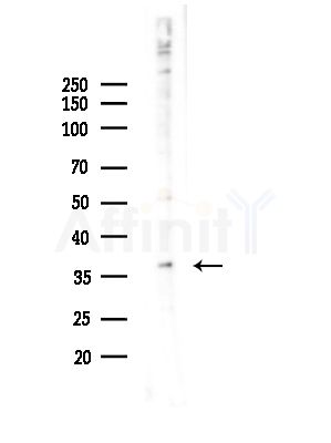PIH1D1 Antibody - Western blot analysis of lysates from Hela cells(starvation,24h treatment), using PIH1D1 Antibody at 1/1000 dilution.