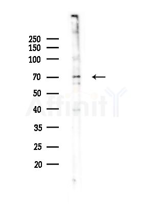 PLAGL2 Antibody - Western blot analysis of lysates from Hela cells(starvation,24h treatment), using PLAGL2 Antibody at 1/1000 dilution.