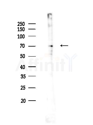 PLAGL2 Antibody - Western blot analysis of lysates from A375 cells(heat-shock,45min treatment), using PLAGL2 Antibody at 1/1000 dilution.