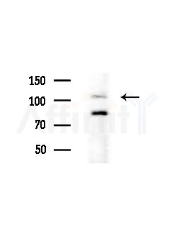 PLEKHG5 Antibody - Western blot analysis of extracts from HepG2 cells(LPS, 4h treatment), using PLEKHG5 Antibody at 1/1000 dilution.