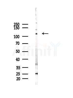 PLEKHG5 Antibody - Western blot analysis of lysates from HepG2 cells(LPS, 4h treatment), using PLEKHG5 Antibody at 1/1000 dilution.
