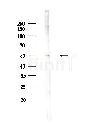 POPDC3 Antibody - Western blot analysis of lysates from A375 cells(heat-shock,45min treatment), using POPDC3 Antibody at 1/1000 dilution.