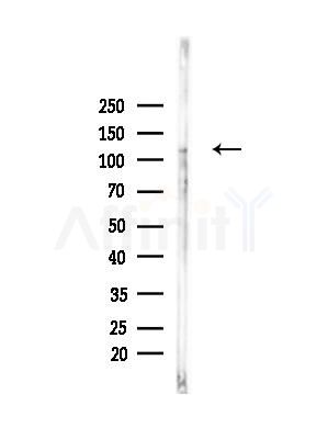 PPARGC1B Antibody - Western blot analysis of lysates from Raji cells(heat-shock,45min treatment), using PPARGC1B Antibody at 1/1000 dilution.