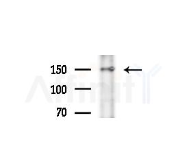 PRUNE2 Antibody - Western blot analysis of extracts from Hela cells(heat-shock treatment), using PRUNE2 Antibody at 1/1000 dilution.