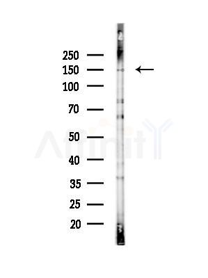 PRUNE2 Antibody - Western blot analysis of lysates from Hela cells(heat-shock,45min treatment), using PRUNE2 Antibody at 1/1000 dilution.