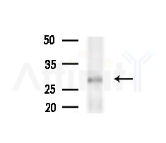 RABL3 Antibody - Western blot analysis of extracts from Rat liver, using RABL3 Antibody at 1/1000 dilution.