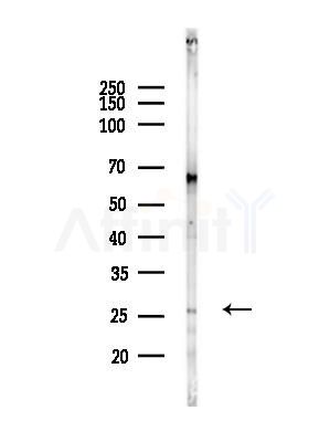 RABL3 Antibody - Western blot analysis of lysates from Rat liver, using RABL3 Antibody at 1/1000 dilution.