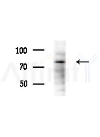 RHOT2 Antibody - Western blot analysis of extracts from HepG2 cells(LPS, 4h treatment), using RHOT2 Antibody at 1/1000 dilution.