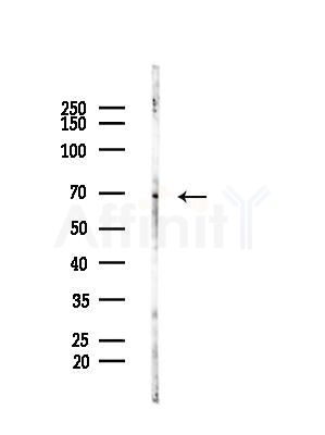RHOT2 Antibody - Western blot analysis of lysates from HepG2 cells(LPS, 4h treatment), using RHOT2 Antibody at 1/1000 dilution.