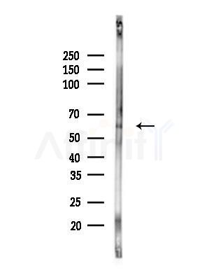 RIC8A Antibody - Western blot analysis of lysates from Rat liver, using RIC8A Antibody at 1/1000 dilution.