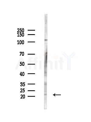 RNASEH2C Antibody - Western blot analysis of lysates from HepG2 cells(LPS, 4h treatment), using RNASEH2C Antibody at 1/1000 dilution.