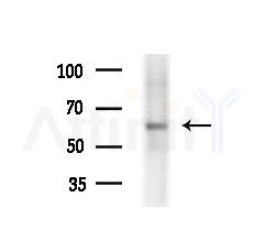 Ribophorin I Antibody - Western blot analysis of extracts from Hela cells(heat-shock treatment), using Ribophorin I Antibody at 1/1000 dilution.