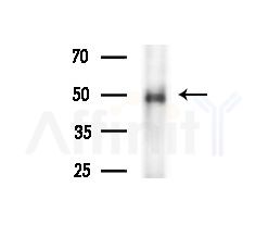 SESN3 Antibody - Western blot analysis of extracts from Mouse brain, using SESN3 Antibody at 1/1000 dilution.