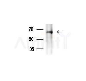 SLC19A3 Antibody - Western blot analysis of extracts from Hela cells(heat-shock treatment), using SLC19A3 Antibody at 1/1000 dilution.