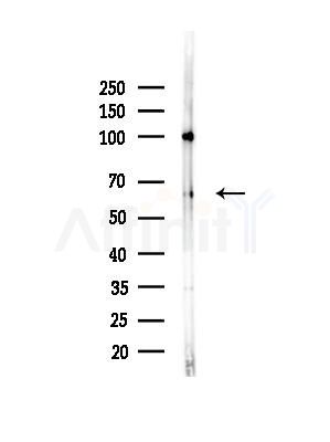 SLC19A3 Antibody - Western blot analysis of lysates from Hela cells(heat-shock,45min treatment), using SLC19A3 Antibody at 1/1000 dilution.