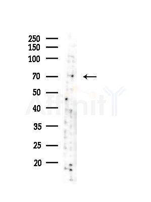SOX5 Antibody - Western blot analysis of lysates from Hela cells(starvation,24h treatment), using SOX5 Antibody at 1/1000 dilution.