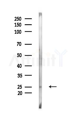 SPRR3 Antibody - Western blot analysis of lysates from EC304 cells(heat-shock,45min treatment), using SPRR3 Antibody at 1/1000 dilution.