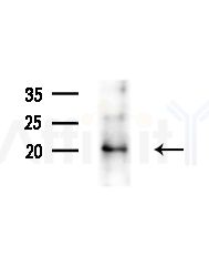 SRP19 Antibody - Western blot analysis of extracts from HepG2 cells(LPS, 4h treatment), using SRP19 Antibody at 1/1000 dilution.