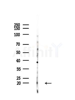 SRP19 Antibody - Western blot analysis of lysates from HepG2 cells(LPS, 4h treatment), using SRP19 Antibody at 1/1000 dilution.