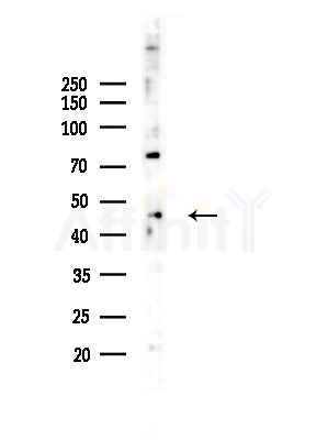 ST8SIA2 Antibody - Western blot analysis of lysates from Hela cells(starvation,24h treatment), using ST8SIA2 Antibody at 1/1000 dilution.