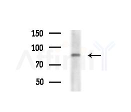 STRA6 Antibody - Western blot analysis of extracts from Rat liver, using STRA6 Antibody at 1/1000 dilution.