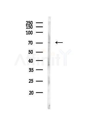STRA6 Antibody - Western blot analysis of lysates from Rat liver, using STRA6 Antibody at 1/1000 dilution.