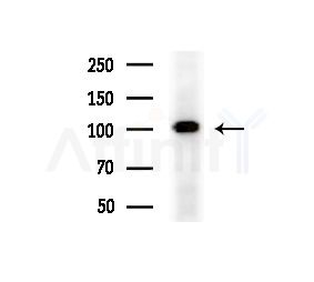 STT3A Antibody - Western blot analysis of extracts from Raji cells(heat-shock treatment), using STT3A Antibody at 1/1000 dilution.
