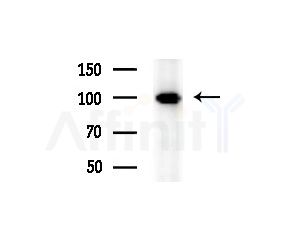STT3A Antibody - Western blot analysis of extracts from Hela cells(heat-shock treatment), using STT3A Antibody at 1/1000 dilution.