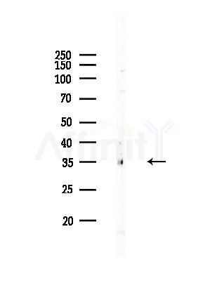 Syntaxin4 Antibody - Western blot analysis of lysates from MDA-MB-231 cells(heat-shock, 45min treatment), using Syntaxin4 Antibody at 1/1000 dilution.