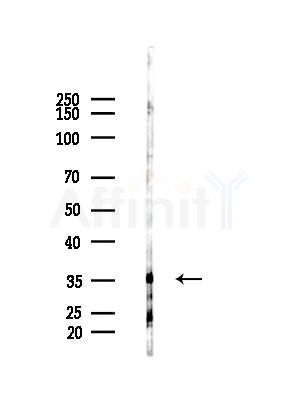 Syntaxin7 Antibody - Western blot analysis of lysates from HepG2 cells(LPS, 4h treatment), using Syntaxin7 Antibody at 1/1000 dilution.
